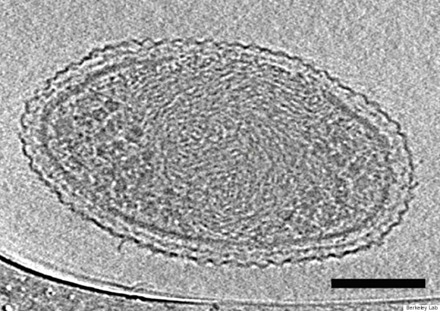 这张照片显示了极小细菌的内部结构。该细胞有致密的内部间隔和复杂的细胞壁。比例尺为100纳米。