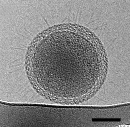 极小细菌表面发散出无数毛发状结构，科学家认为这些结构的作用是连接细胞和其它微生物，图片的比例尺为100纳米。