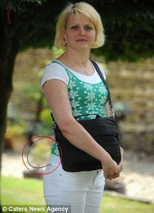 30岁英国少妇Daniela Vargova于2013年8月植入左心室辅助装置，依赖背包中的电池组供电维持生命
