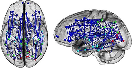 成年男性的脑部神经连接示意图（男性更多在半球内的连接）
