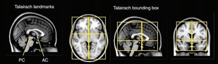 塔莱拉什大脑图谱中的空间坐标