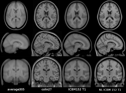 柯林27（Colin27）标准大脑图（图片来源：Evans, et al., 2012）